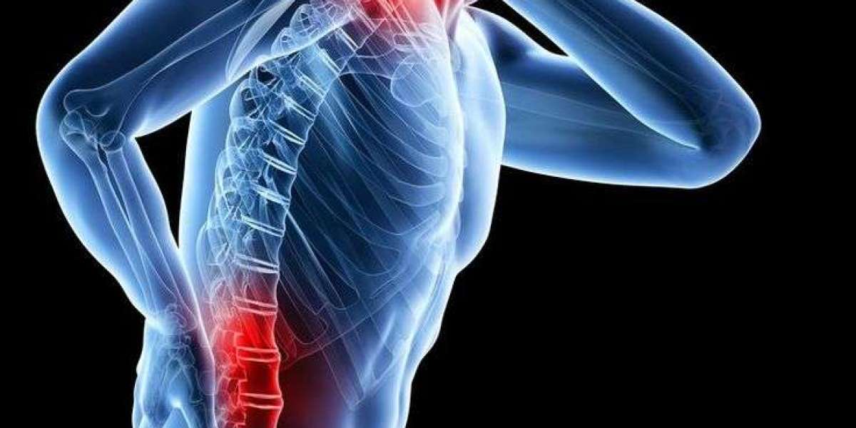 Prosoma: The Breakthrough Solution for Chronic Neck and Back Pain