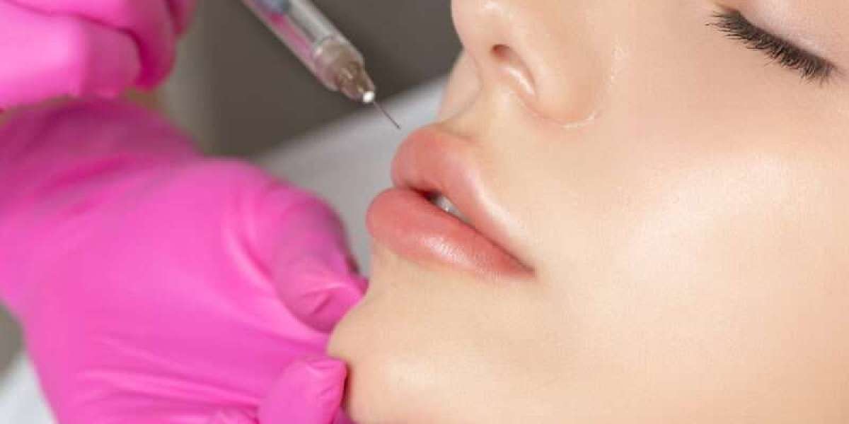 Dubai’s Hottest Beauty Trend: Is the Botox Lip Flip Right for You?