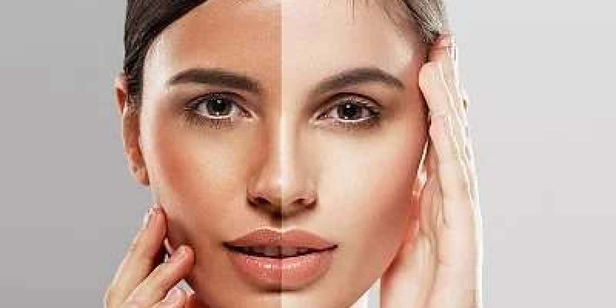 Glow Brighter Than Ever: Why Skin Whitening in Dubai Is a Must-Try