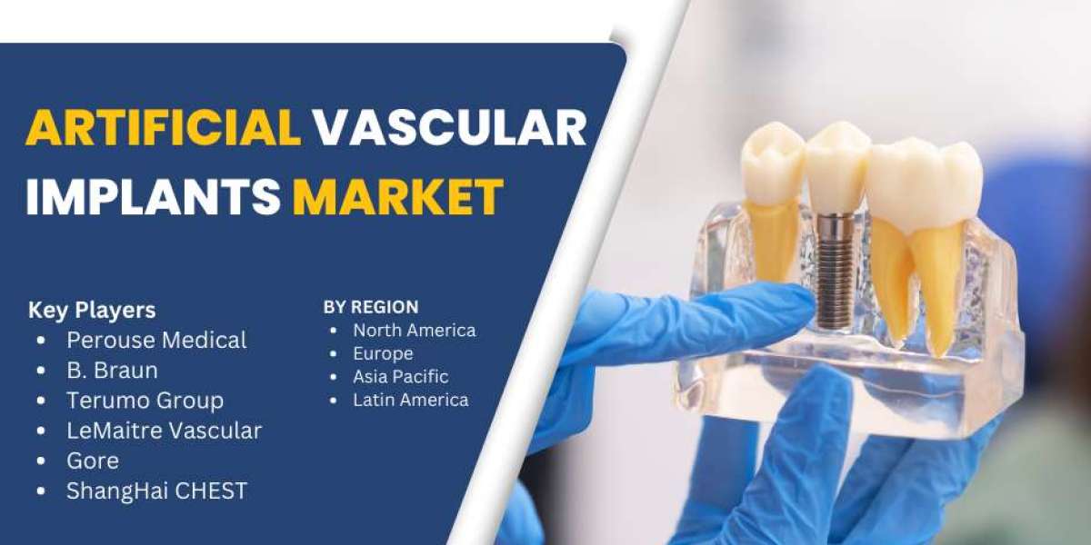 Artificial Vascular Implants Market Industry: Growth and Forecast 2033 | Market Strides