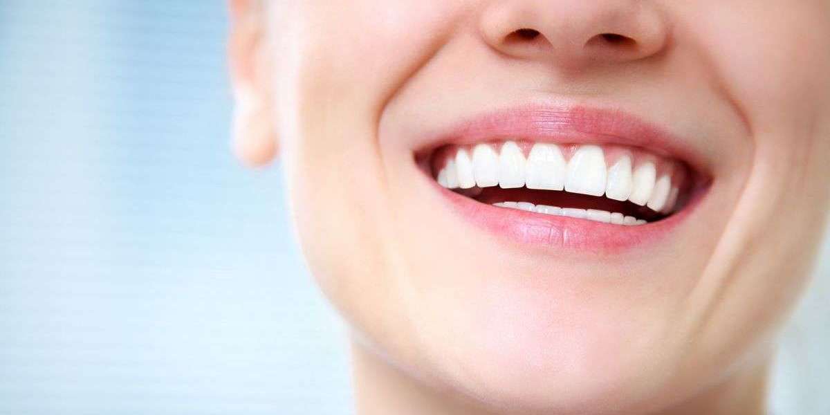 Achieve a Brighter Smile: Your Complete Guide to Crest Teeth Whitening Strips in the UK