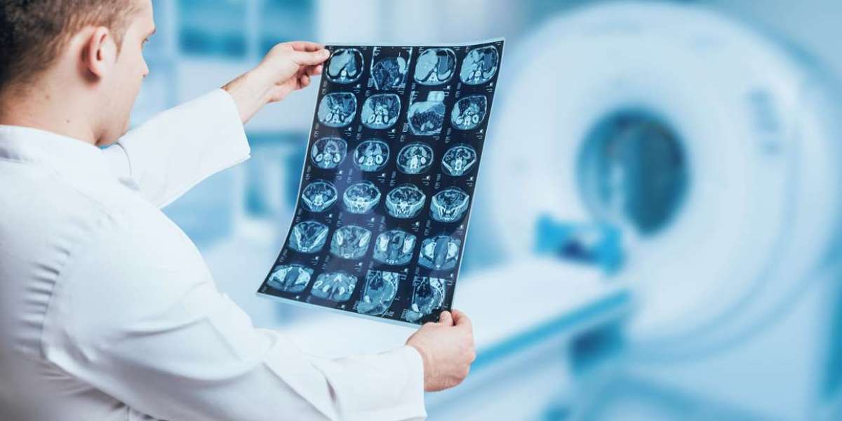 Advanced Radiology Services: Transforming Diagnostics and Treatment