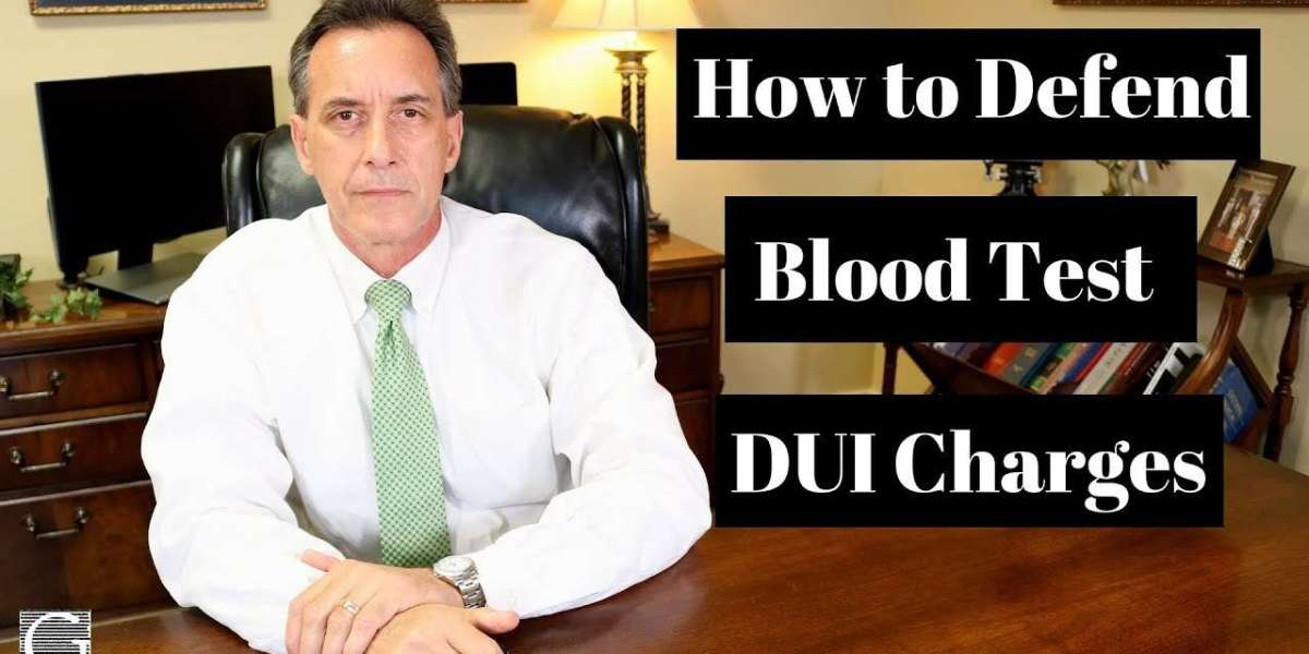 The Ultimate Guide to Beating a DUI Charge: How to Build the Best Defence