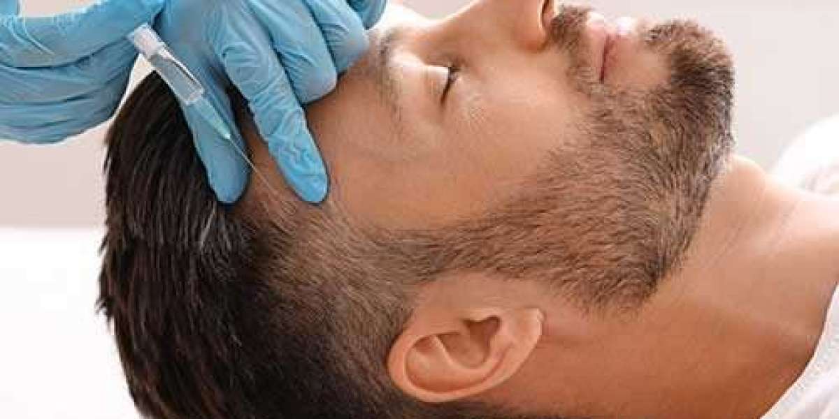 Laser Therapy for Hair Loss in Islamabad — Does It Deliver Results?