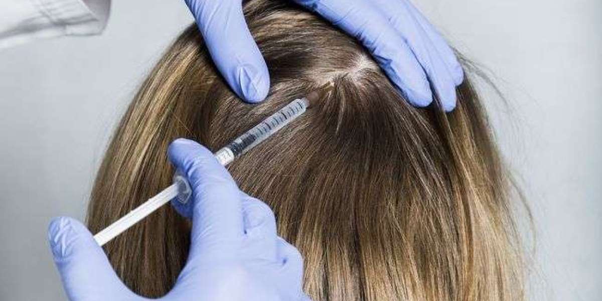 What to Avoid After Getting GFC Hair Treatment in Dubai