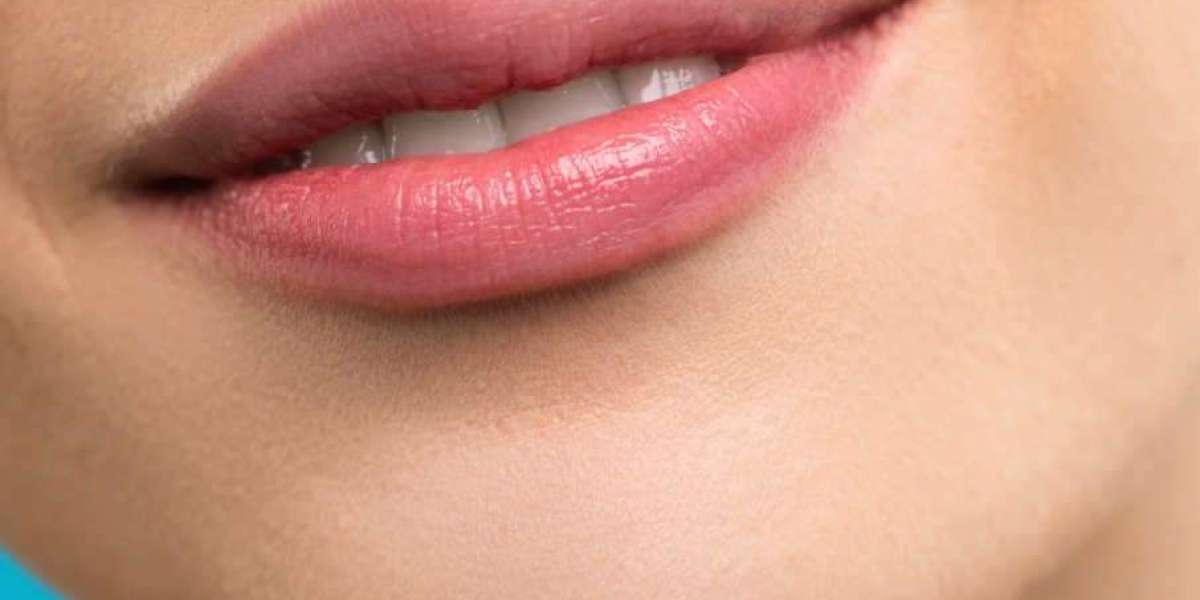 How Lip Augmentation Can Transform Your Smile