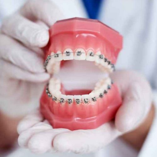 Best Orthodontic Clinic in Ajman: Orthodontist in Ajman