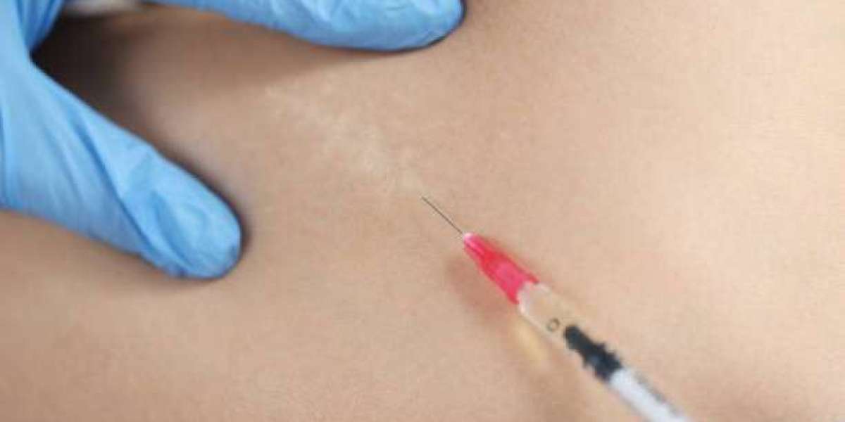 Why Everyone in Dubai is Talking About Fat-Melting Injections