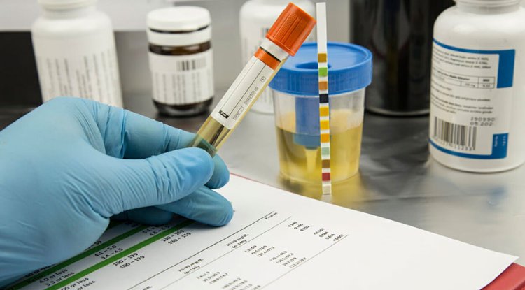 Top 5 Surprising Benefits of Getting a Blood Test in Tampa - Biphoo