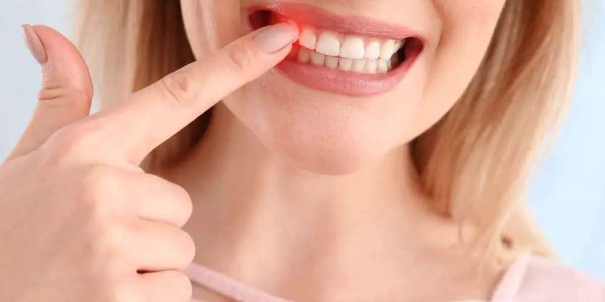 Exploring the Different Types of Gum Contouring Techniques