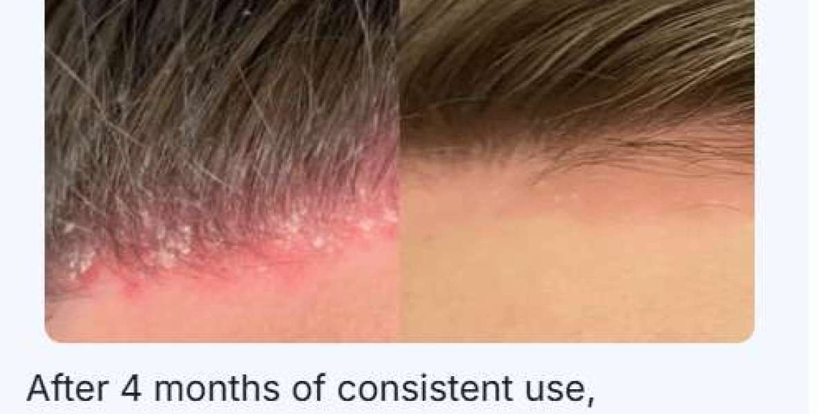 https://www.facebook.com/ReGenixalHairOilAustralia/