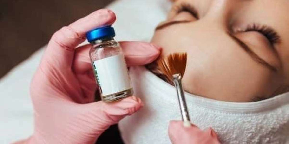 What Is the Ideal Age to Start Chemical Peel Treatments?
