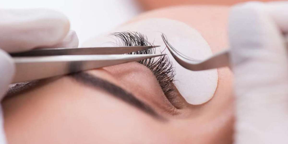 Eyelash Transplants vs Extensions: Which One Lasts Longer?
