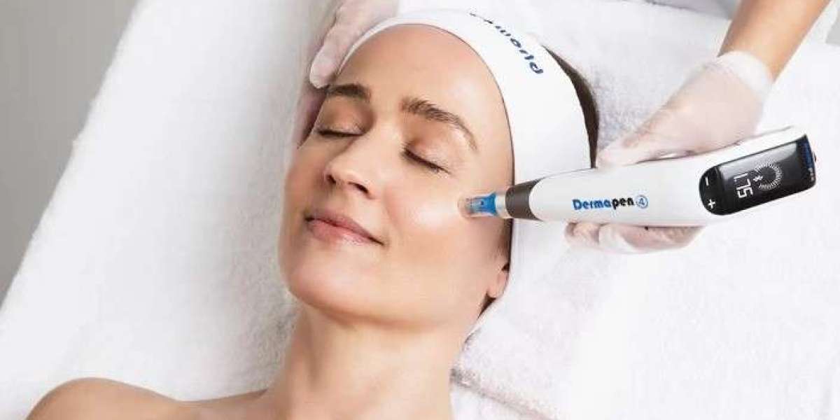Microneedling for Ageless and Glowing Skin: A Revolutionary Treatment