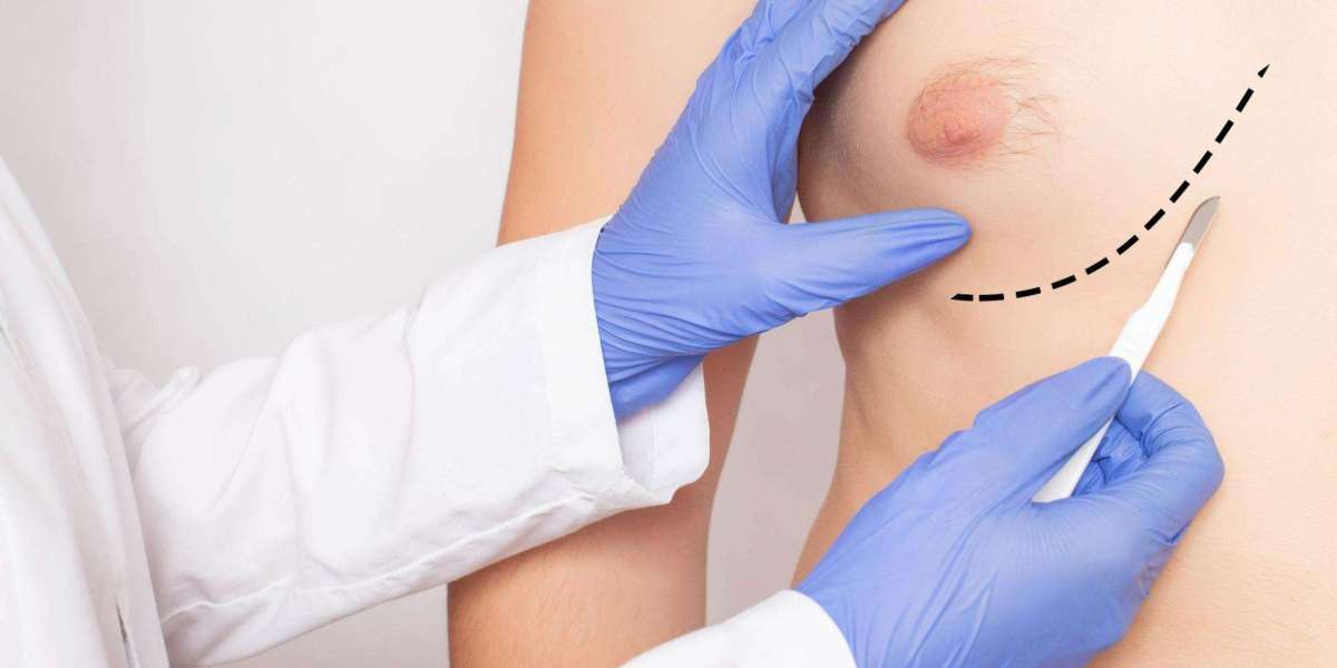 How Long Does Gynecomastia Surgery Take?