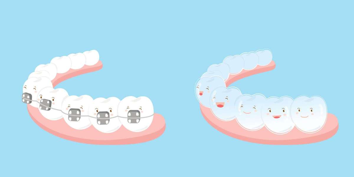 The Future of Orthodontics: What Experts Are Excited About