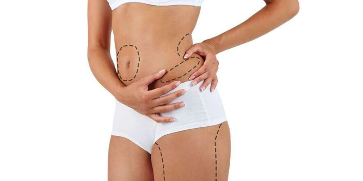 Power-Assisted Liposuction: Is It Available in Islamabad?