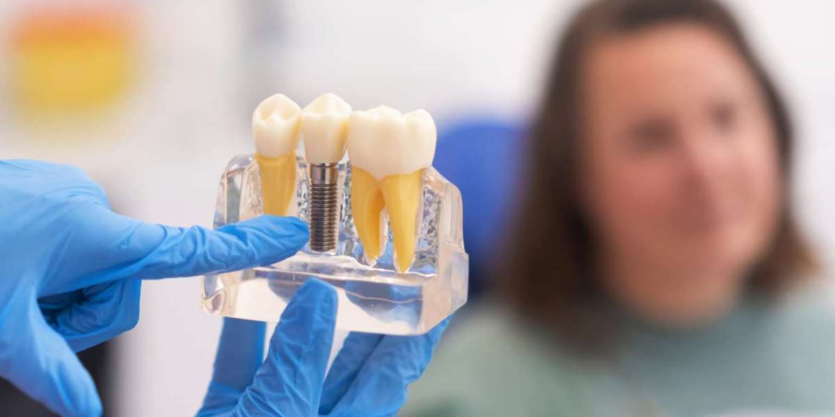 Affordable Dental Implant Clinics in Islamabad