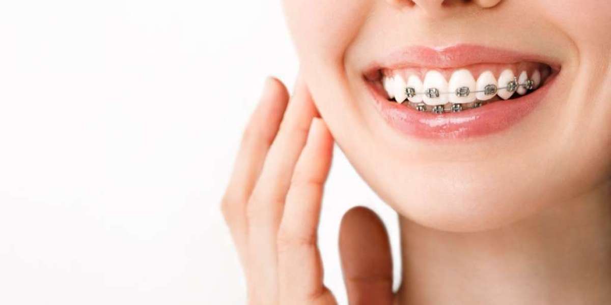 Orthodontic Solutions for Adults Over 40 in Dubai