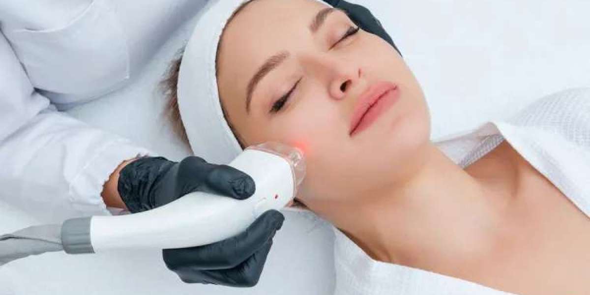 Laser Hair Removal Myths Busted: What Really Happens