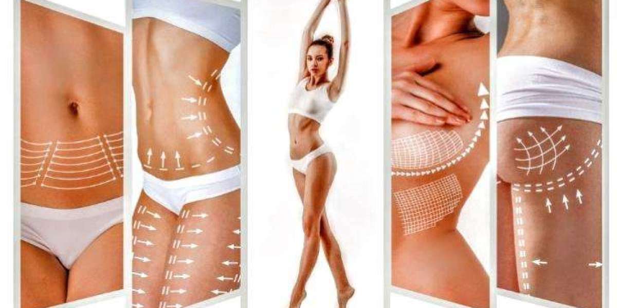 Before & After Photos of Body Contouring in Islamabad