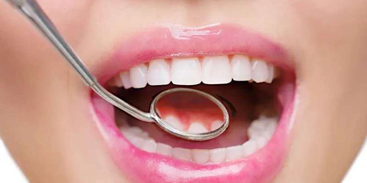 Smile Transformations: How Pink Gums Change Your Entire Look