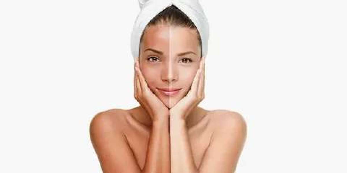 Top Skin Whitening Salons in Islamabad: Reviews and Ratings