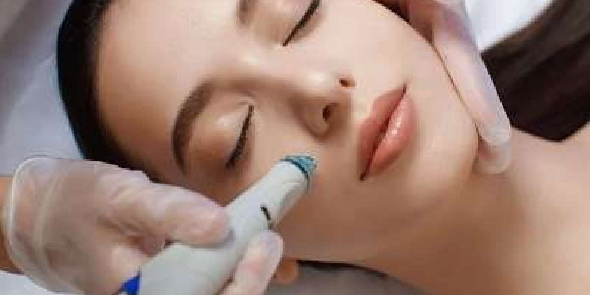 How HydraFacial Complements Laser and Microneedling Treatments
