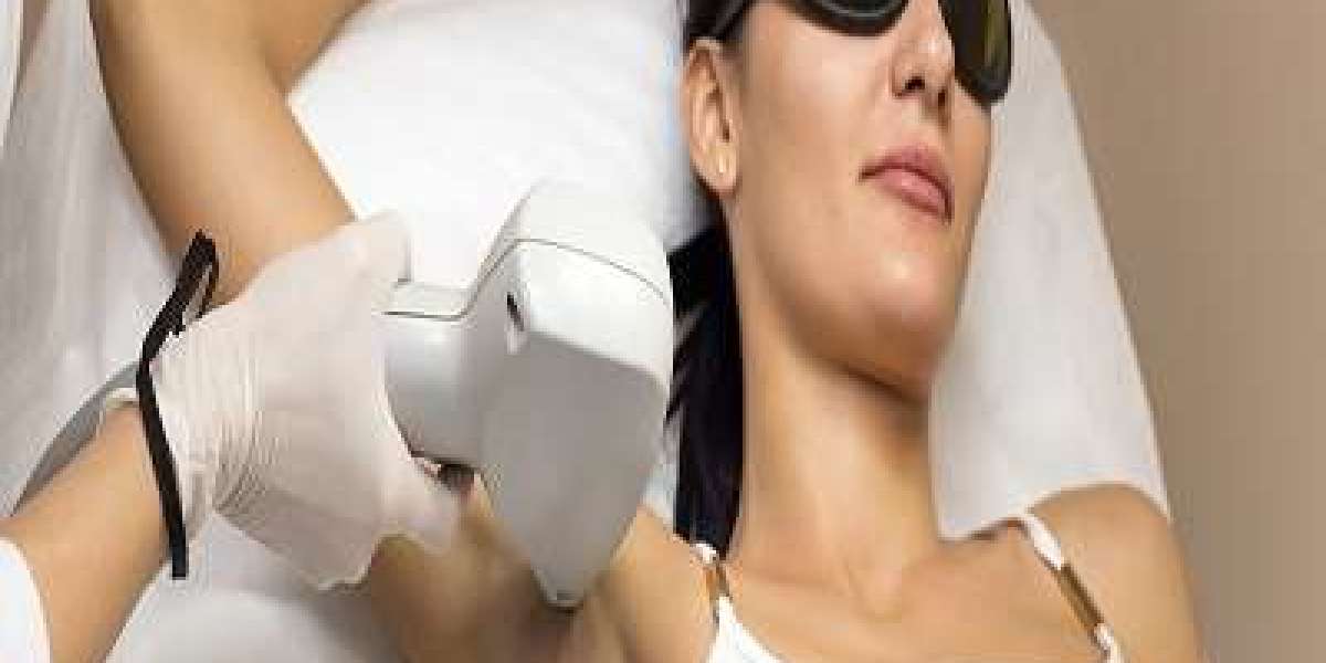 The Evolution of Laser Hair Removal Technology