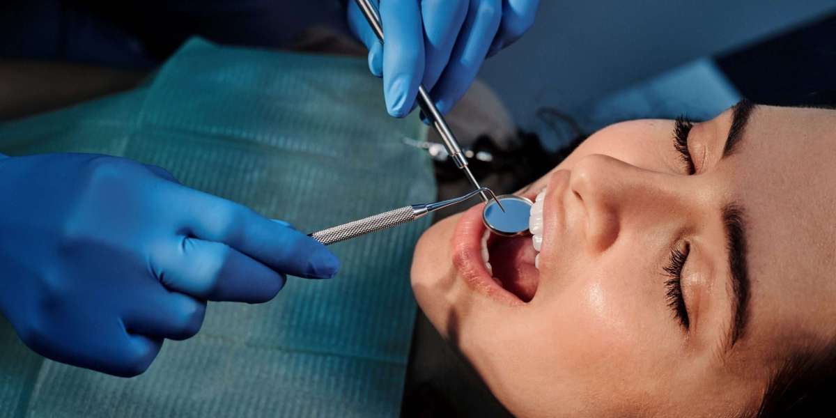 Composite Bonding Aftercare: Do’s and Don’ts for Lasting Results