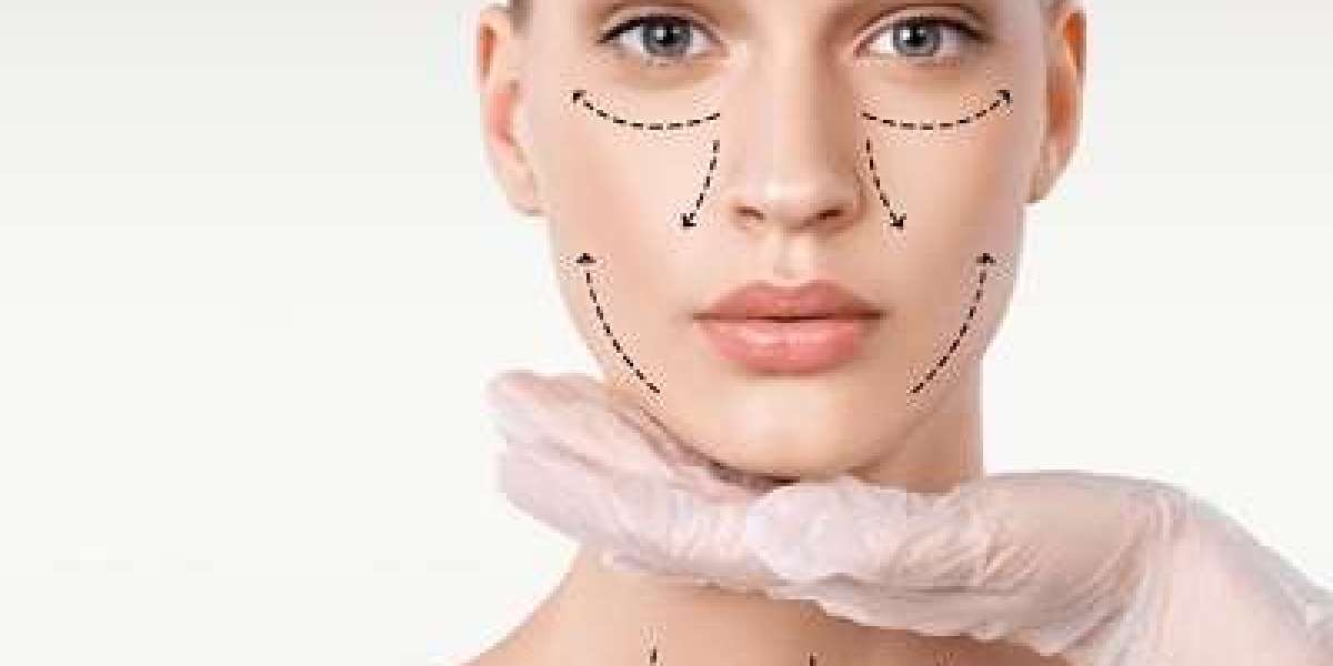 Endoscopic Facelifts: A Minimally Invasive Option