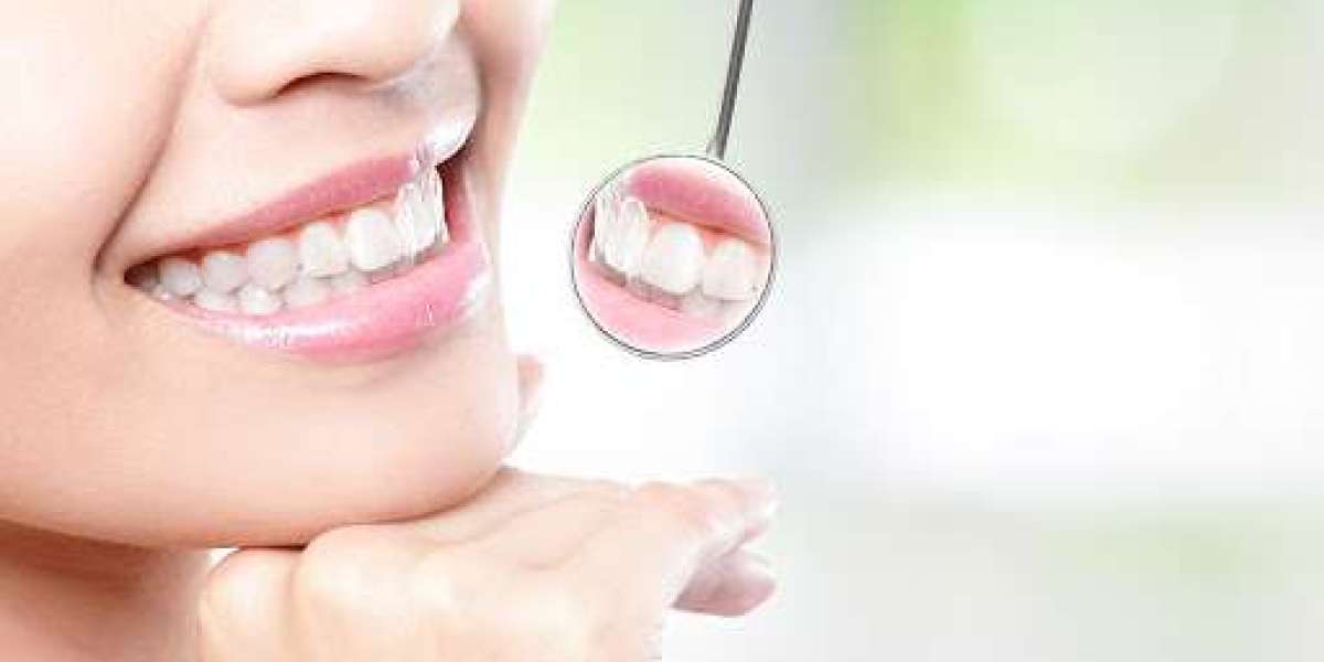 The Growing Popularity of Cosmetic Dentistry: What’s Driving the Trend?