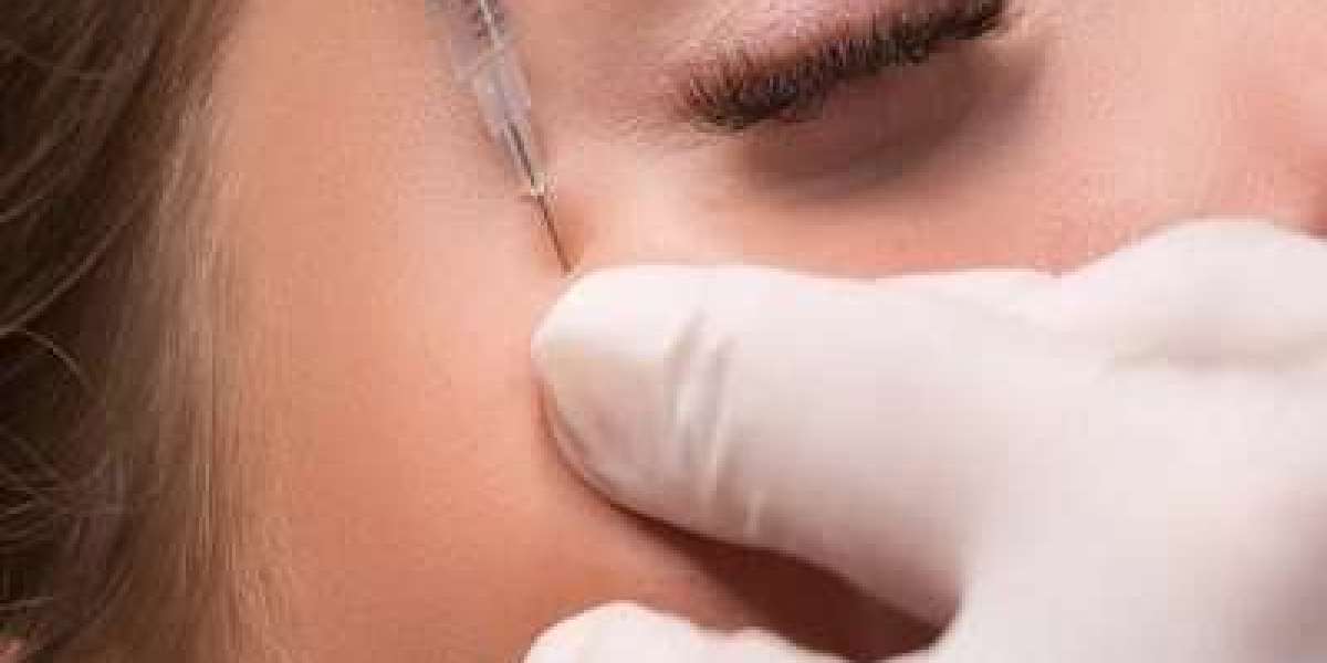 Comparing Lip Fillers: Juvederm vs. Restylane
