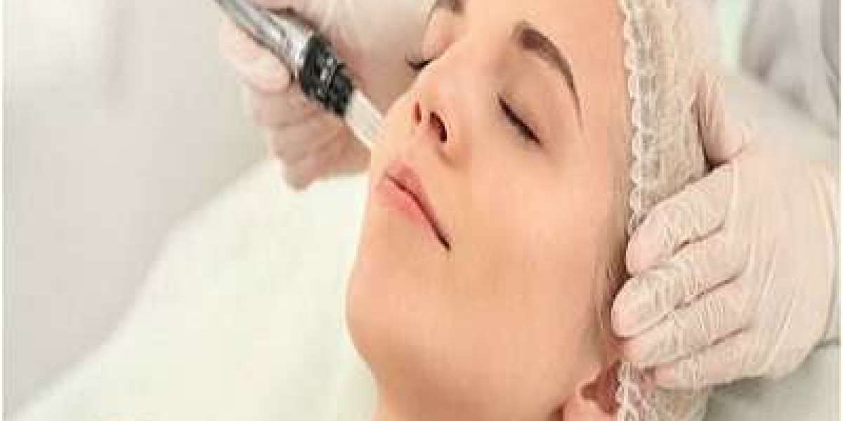 Men’s Guide to Derma Roller Treatment
