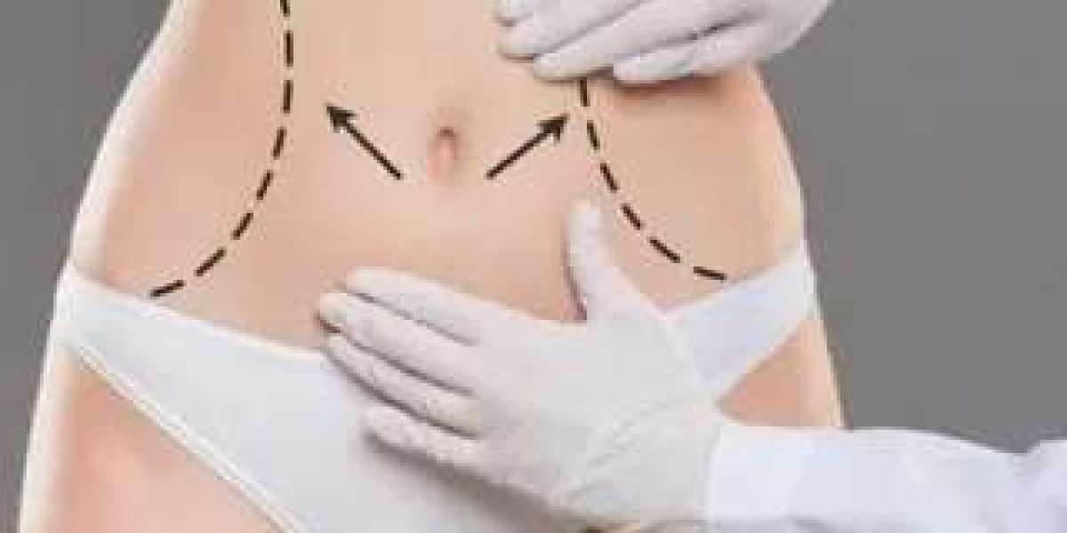 What to Wear After a Tummy Tuck: Islamabad Clinic Tips