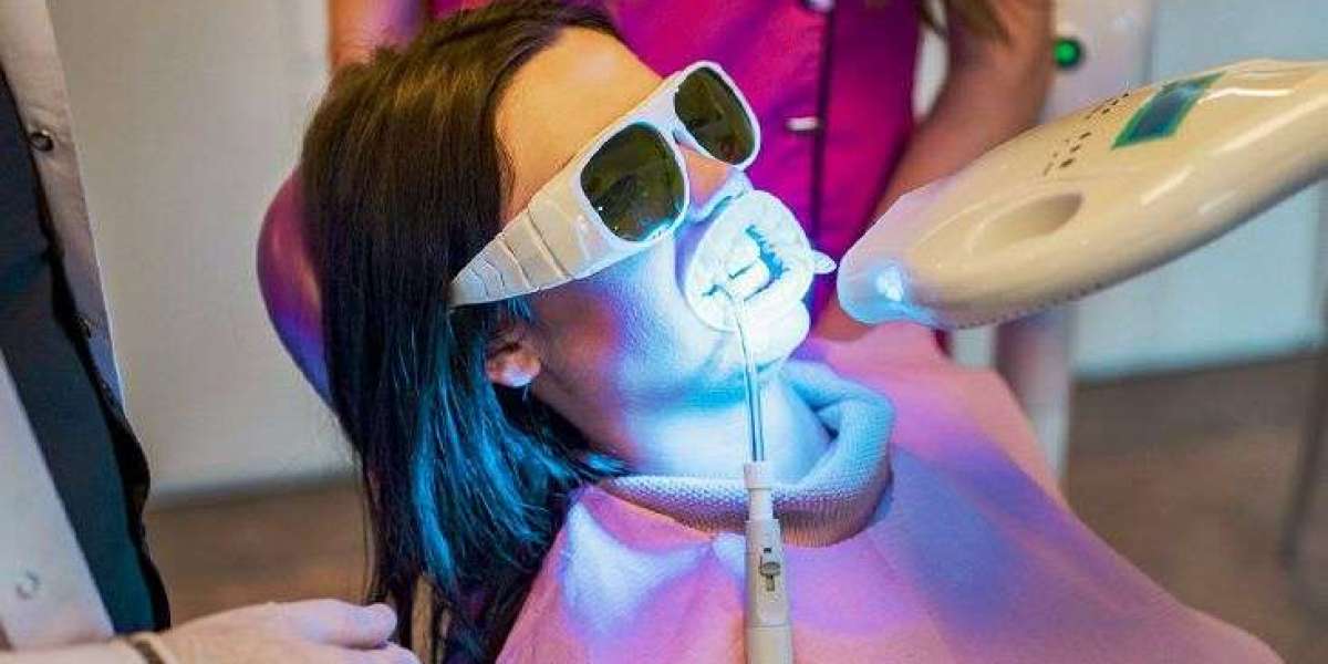 Why Zoom Whitening Is Perfect for Last-Minute Smile Makeovers
