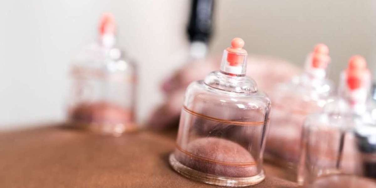 The Revival of Sunnah: Why Hijama Is Gaining Popularity