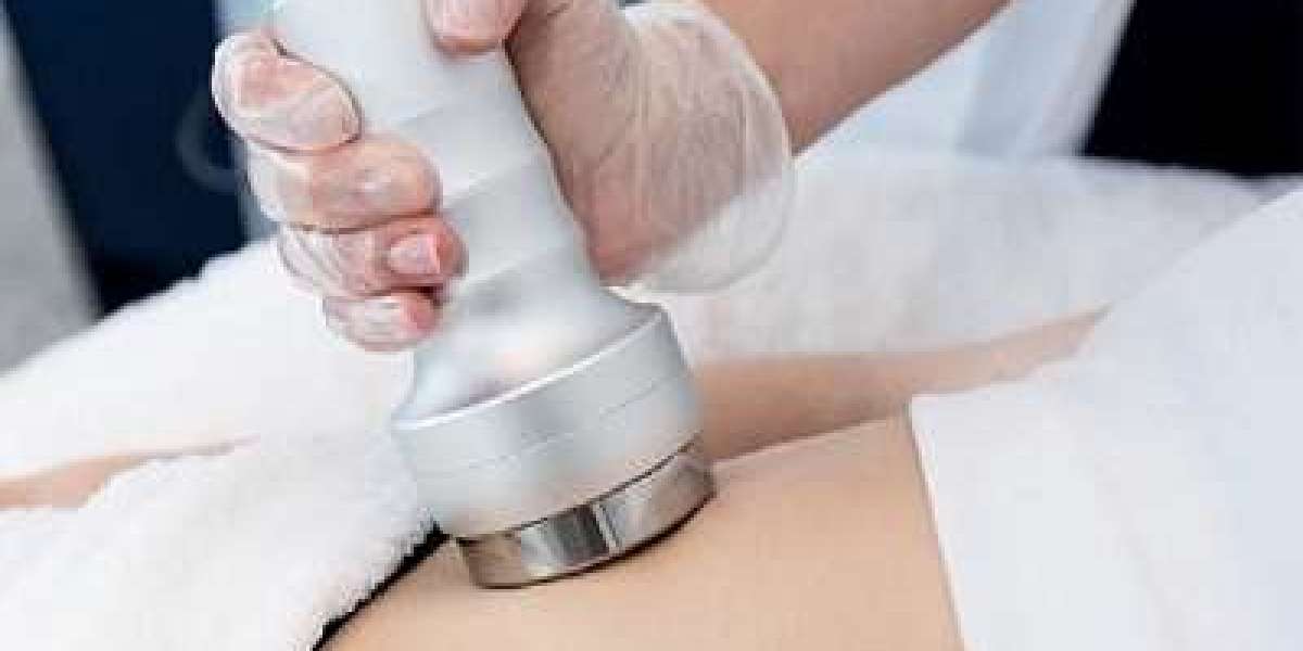 Trending Now: The Best Cellulite Treatments