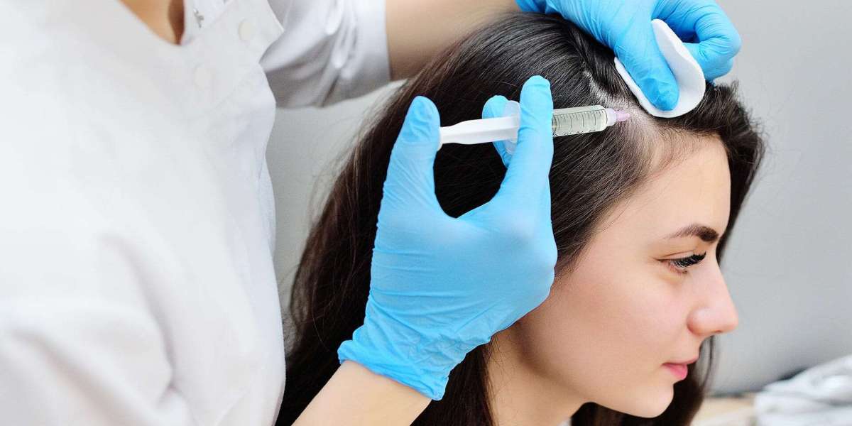 PRP Hair Therapy Explained: Is It Right for You?