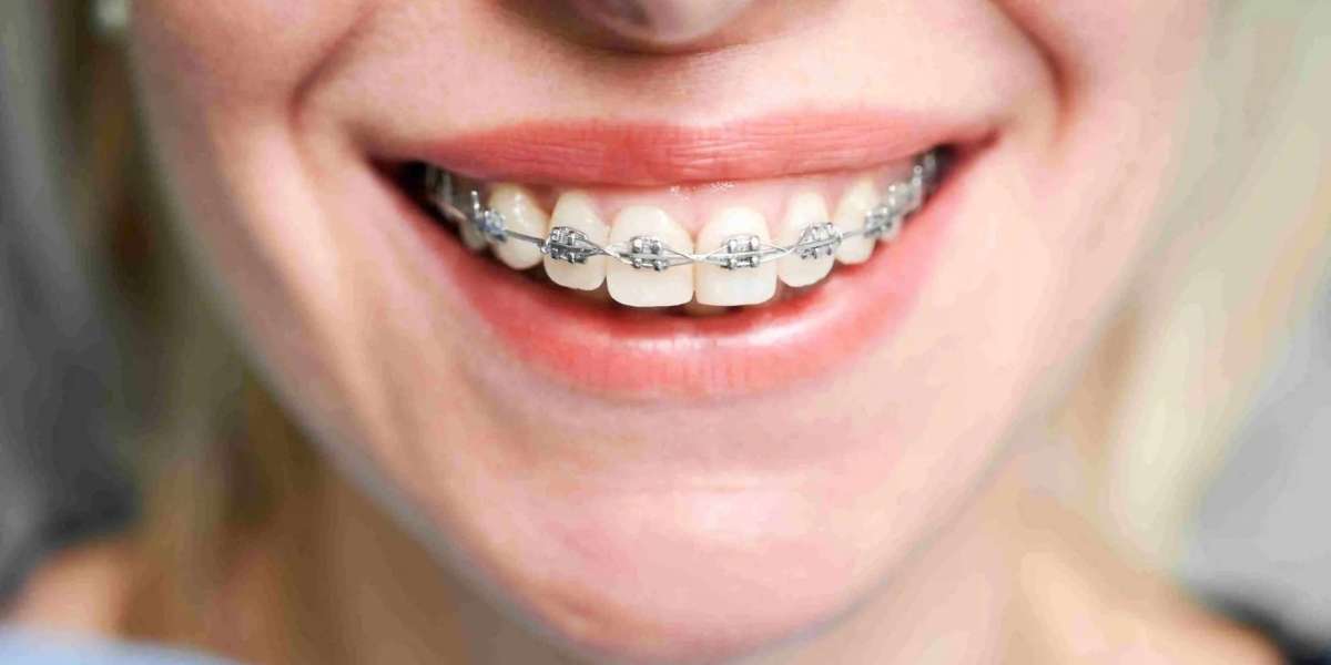 Top-Rated vs. Best Orthodontist: Is There a Difference?