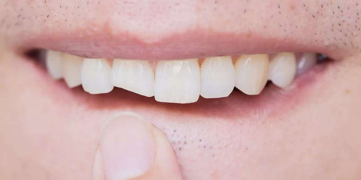 How is an emergency dentist different than a regular dentist?
