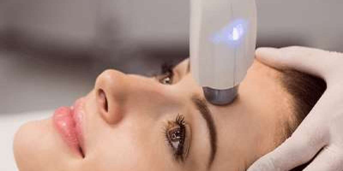 HIFU for Neck Tightening: What You Should Expect