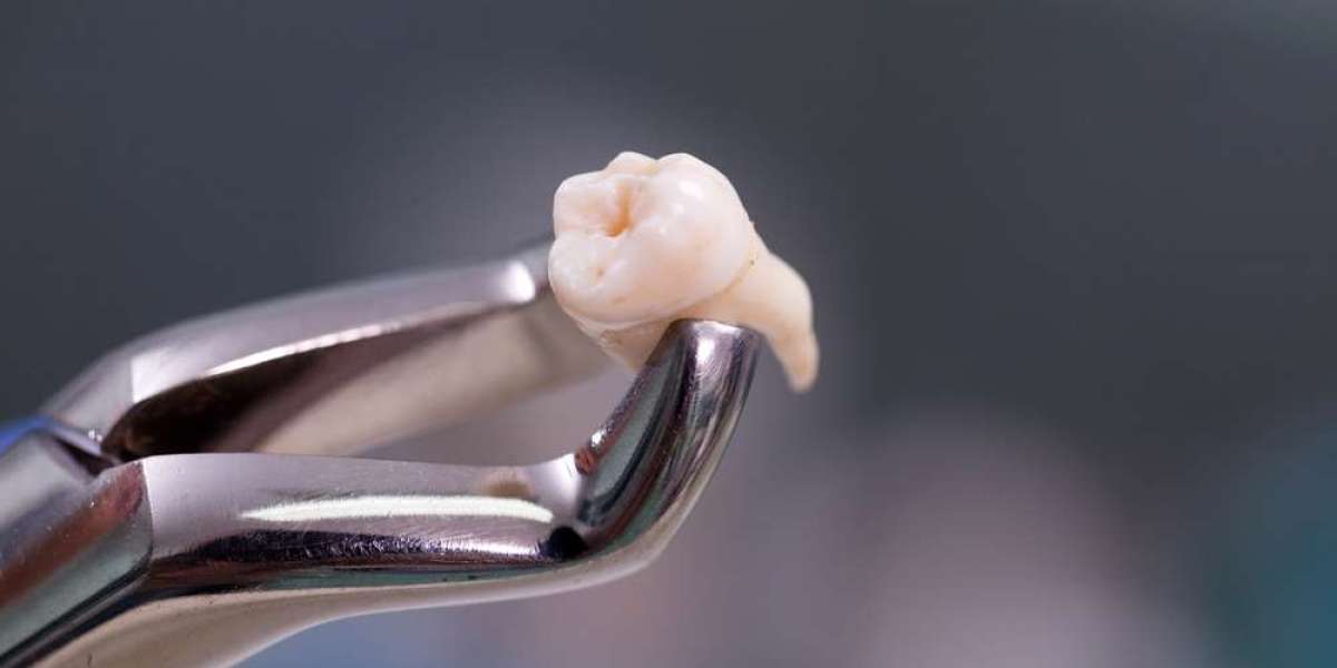 Can You Reverse Tooth Damage and Avoid Extraction?
