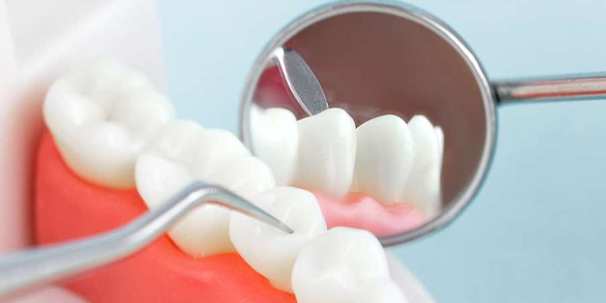 The Psychological Impact of Losing Your Teeth and Getting Dentures