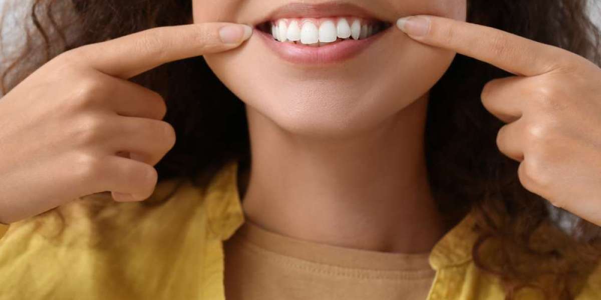 Permanent Gum Bleaching: Is It Worth the Investment?