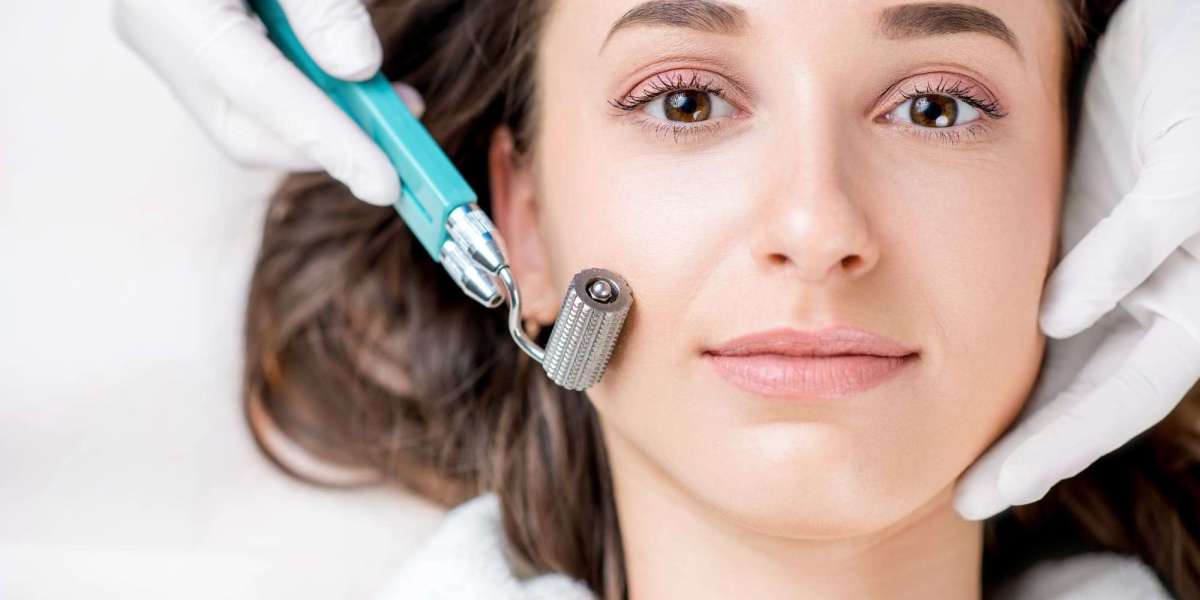 PRP Microneedling vs. Traditional Microneedling