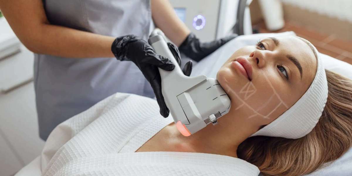 HIFU Stimulates Collagen for Long-Term Results