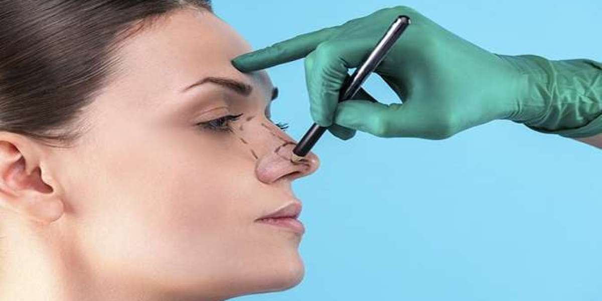 تجارب واقعية من الرياض: هذا ما قاله المرضى عن تجميل الأنف