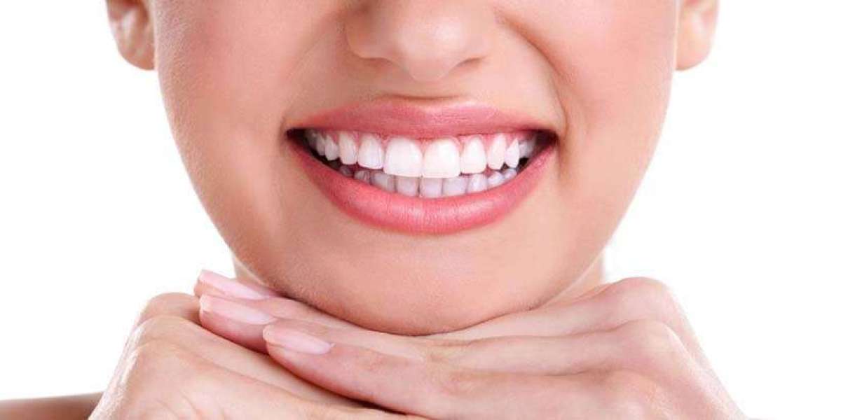 How to Find the Best Gum Depigmentation Specialist for You
