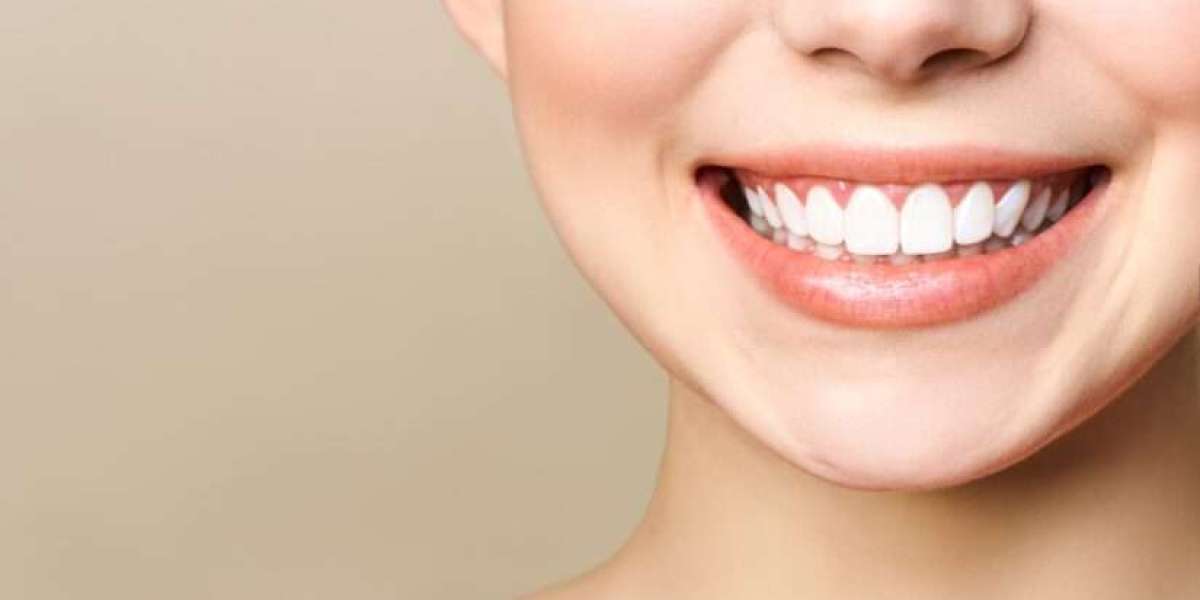 Smile Goals: Realistic Expectations in Cosmetic Dental Procedures